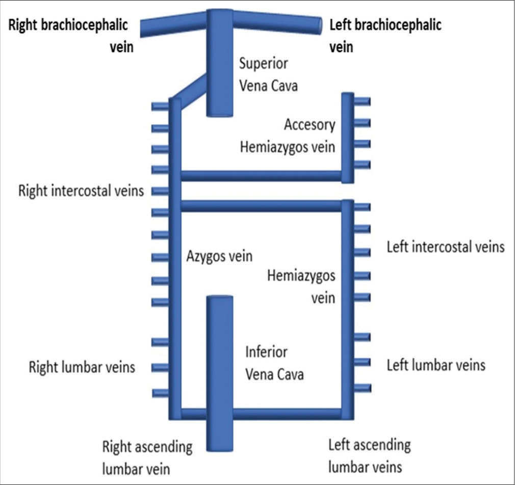 Schematic diagram of azygos vein anatomy.